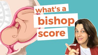 BISHOP SCORE EXPLAINED [upl. by Loggia790]