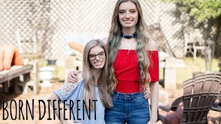 My Identical Twin With Dwarfism  BORN DIFFERENT [upl. by Trinetta]