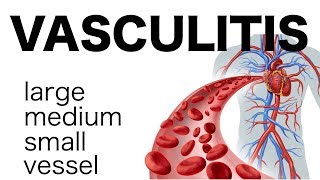 Vasculitis [upl. by Emmery]