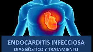 Endocarditis infecciosa  Diagnóstico y tratamiento [upl. by Marolda]